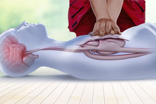 CPR body image CPR body image